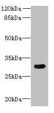 ZDHHC12 Polyclonal Antibody