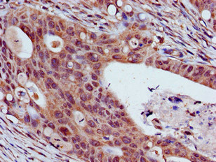 THOC3 Polyclonal Antibody