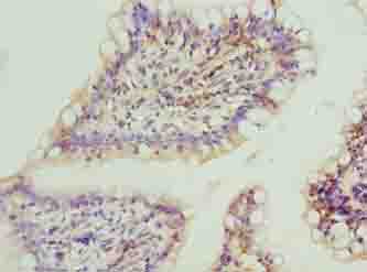FAR2 Polyclonal Antibody
