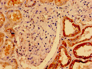 UCN2 Polyclonal Antibody