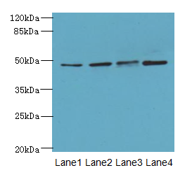 TTC5 Polyclonal Antibody