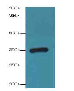 CPXCR1 Polyclonal Antibody