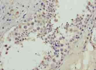 BATF2 Polyclonal Antibody (20 µl)