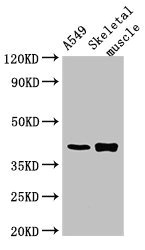 PPM1K Polyclonal Antibody