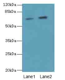 GALNT15 Polyclonal Antibody
