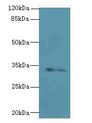 STX19 Polyclonal Antibody