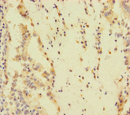 SPEM1 Polyclonal Antibody