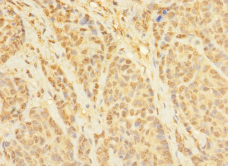 CCDC79 Polyclonal Antibody