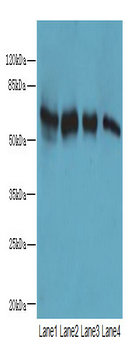 KLHL23 Polyclonal Antibody