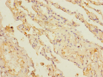 KCTD6 Polyclonal Antibody