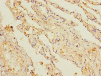 KCTD6 Polyclonal Antibody (50 µl)