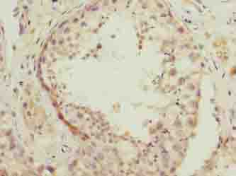 NSUN7 Polyclonal Antibody