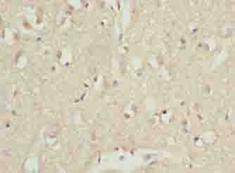 CDC26 Polyclonal Antibody