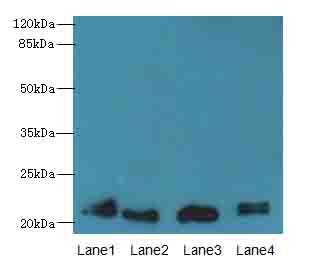 LRRC20 Polyclonal Antibody