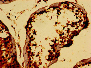 TCP10L Polyclonal Antibody