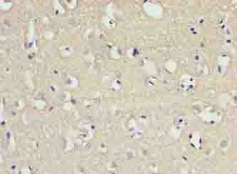 SLC22A17 Polyclonal Antibody