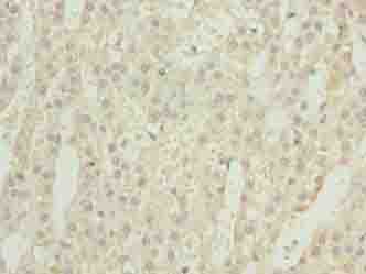 GEMIN6 Polyclonal Antibody