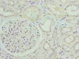 SUSD6 Polyclonal Antibody