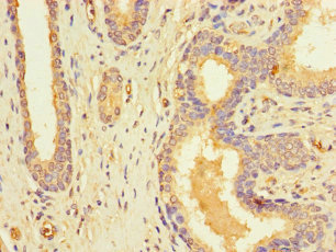 RFK Polyclonal Antibody