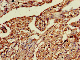 PRR11 Polyclonal Antibody