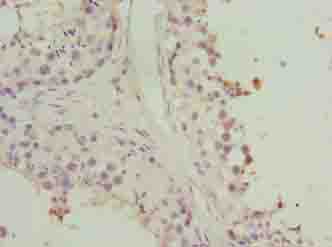 HORMAD2 Polyclonal Antibody