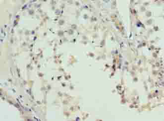 L3MBTL4 Polyclonal Antibody