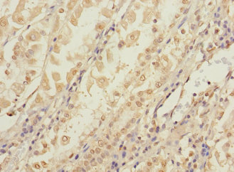 CCDC150 Polyclonal Antibody