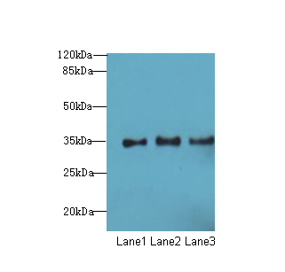 NUP35 Polyclonal Antibody