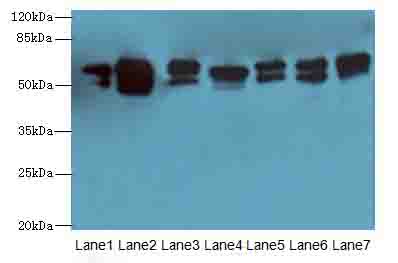 ATL2 Polyclonal Antibody (100 µl)