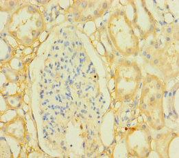 PPTC7 Polyclonal Antibody