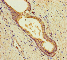 BLOC1S5 Polyclonal Antibody