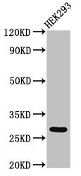 ANKRD49 Polyclonal Antibody (100 µl)