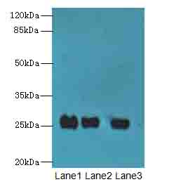 C10orf82 Polyclonal Antibody