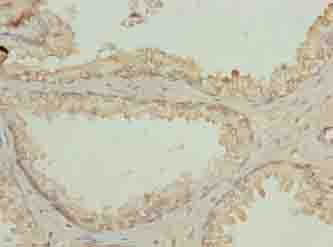 N4BP2L2 Polyclonal Antibody