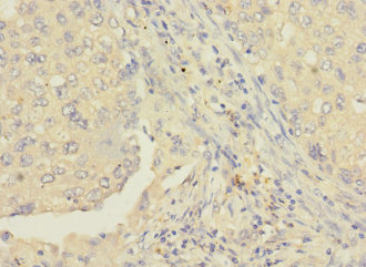 RAB8B Polyclonal Antibody