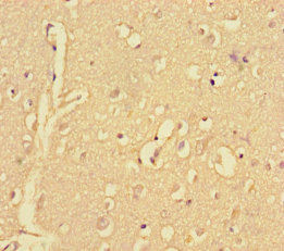 CPNE2 Polyclonal Antibody