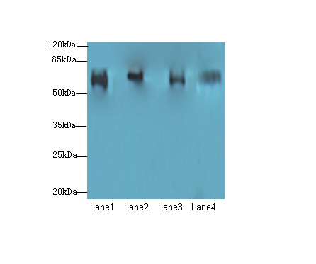 CFAP52 Polyclonal Antibody