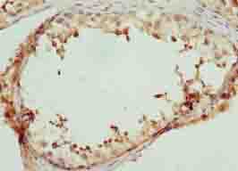 LRRC18 Polyclonal Antibody