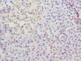 METTL25 Polyclonal Antibody (50 µl)