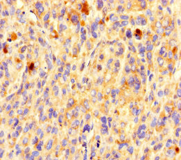 OR5L1 Polyclonal Antibody