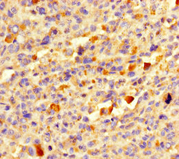 DEFB104A Polyclonal Antibody