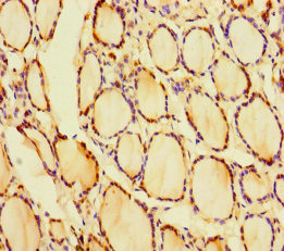 CRYGN Polyclonal Antibody