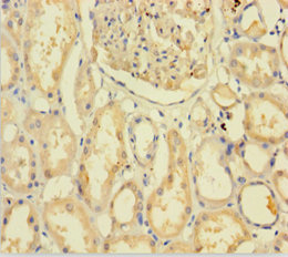C9orf72 Polyclonal Antibody