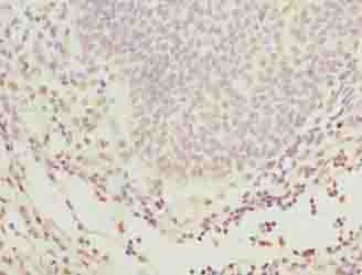 GLT1D1 Polyclonal Antibody