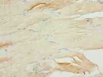 RASL10B Polyclonal Antibody