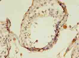 Immunohistochemistry of paraffin-embedded human testis tissue using AADAT Polyclonal Antibody at dilution of 1:100