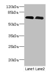 PNPLA1 Polyclonal Antibody