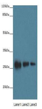 LRRC57 Polyclonal Antibody