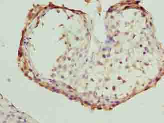 FSIP1 Polyclonal Antibody