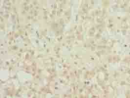 MFSD8 Polyclonal Antibody